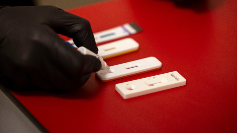 İzmir'de kimliksiz ve ücretsiz HIV, Hepatit ve Sifiliz testi hizmeti