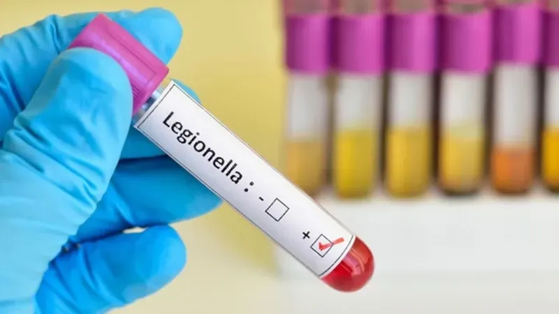 İzmir’de Lejyoner hastalığına karşı eğitim başvuruları başladı